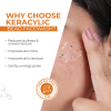 Keracylic Facewash with Active Beads for Acne, Pimple Free and Brighter Skin 70g